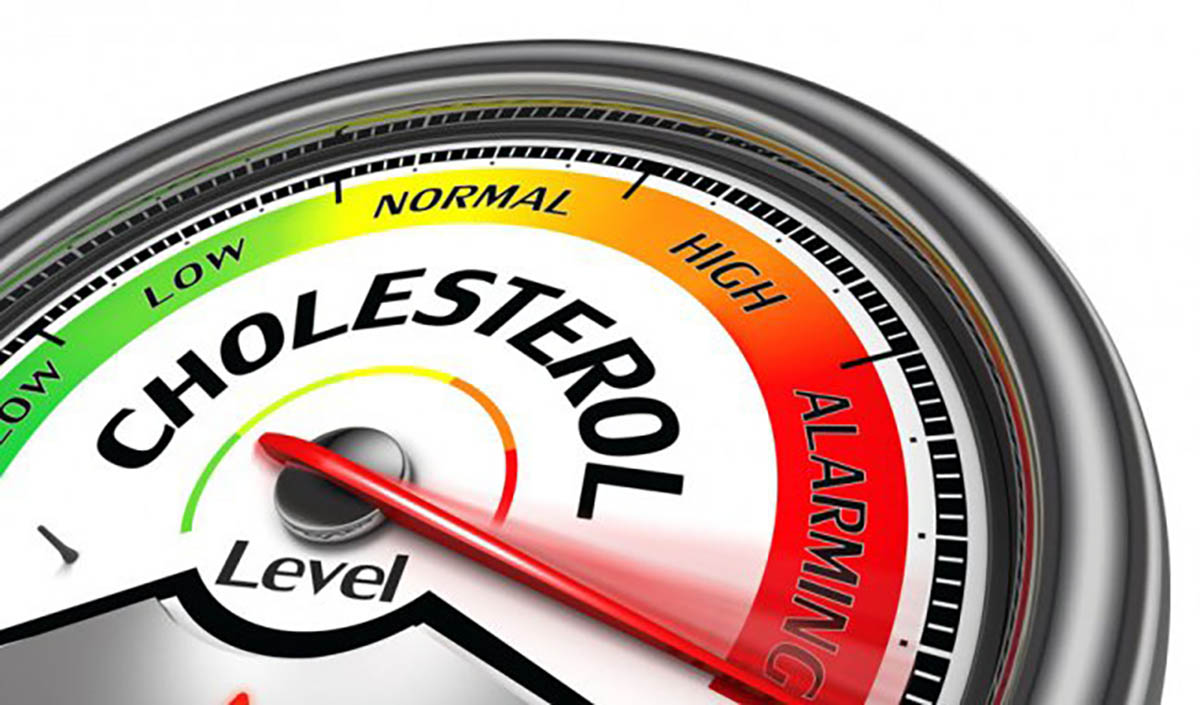 Cholesterol cao và tác hại đối với tim mạch